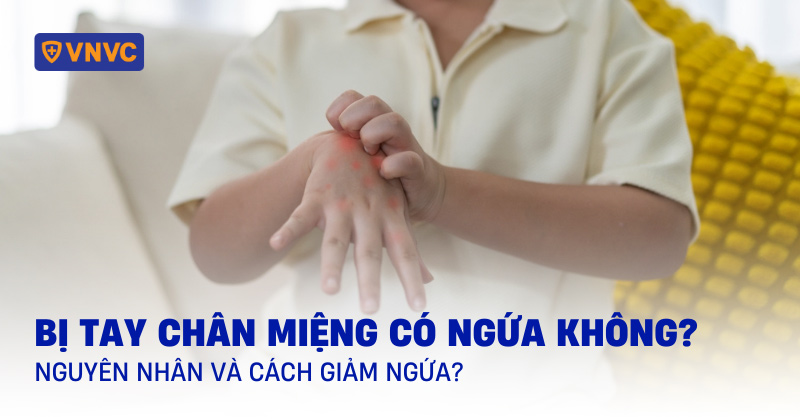 tay chân miệng có ngứa không