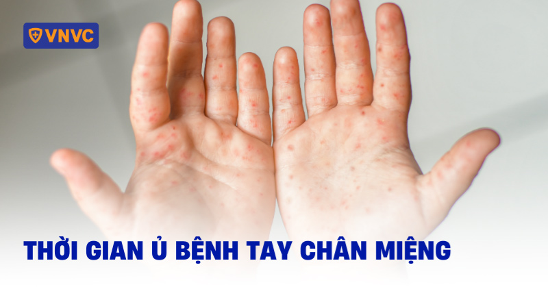 thời gian ủ bệnh tay chân miệng