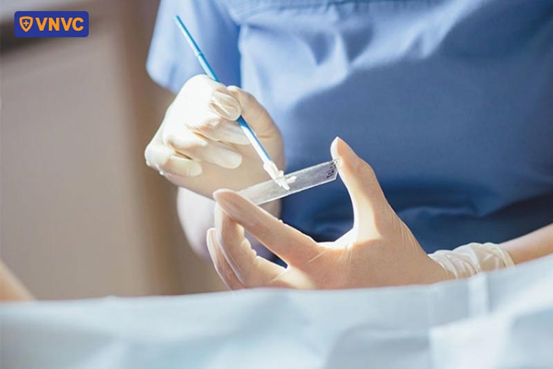 thực hiện tầm soát ung thư cổ tử cung