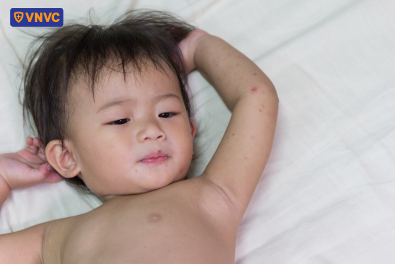trẻ bị giật mình trong tay chân miệng