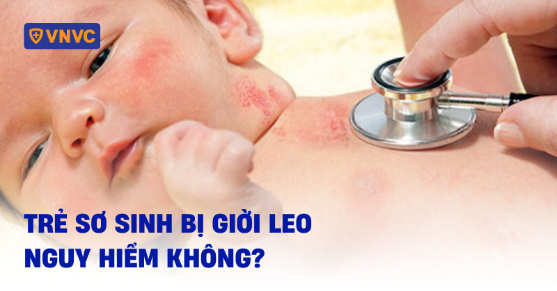 trẻ sơ sinh bị giời leo