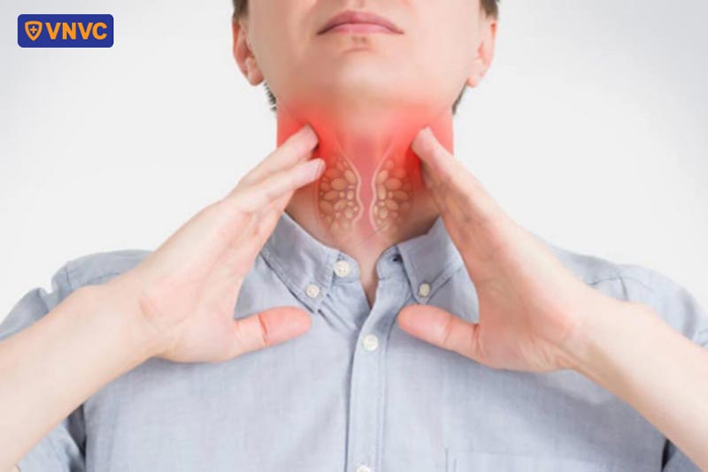 ung thư vòm họng do hpv 68