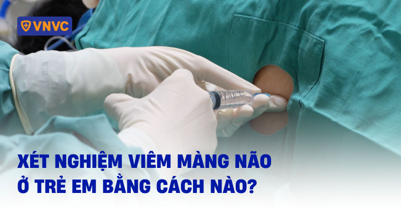 xét nghiệm viêm màng não
