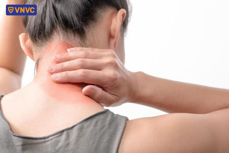 zona thần kinh có thể gây liệt dây thần kinh