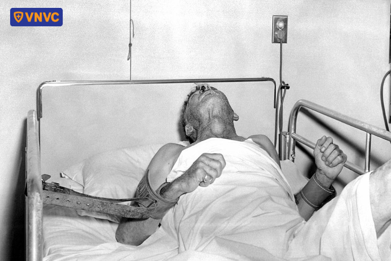 bệnh dại giai đoạn bùng phát triệu chứng