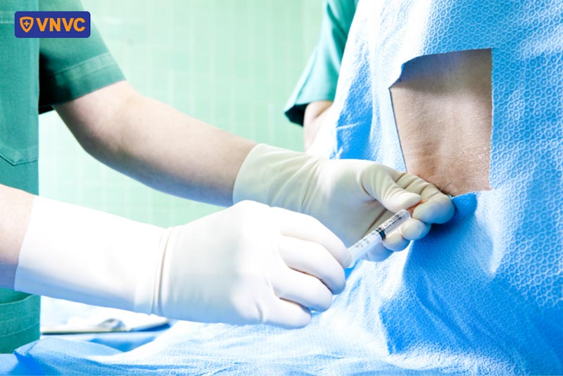 chọc dò tủy sống