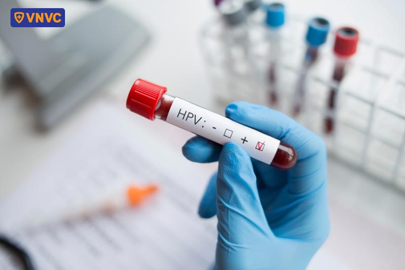 kết quả dương tính với hpv