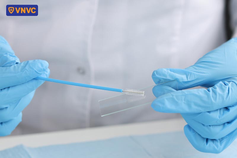 thực hiện xét nghiệm hpv