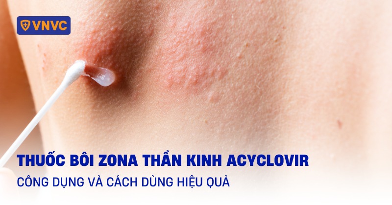 thuốc bôi zona thần kinh acyclovir