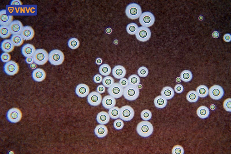 viêm màng não do nấm cryptococcus