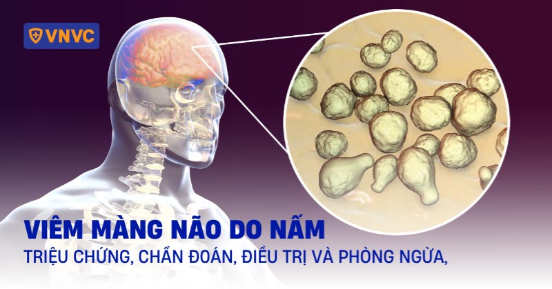 viêm màng não do nấm