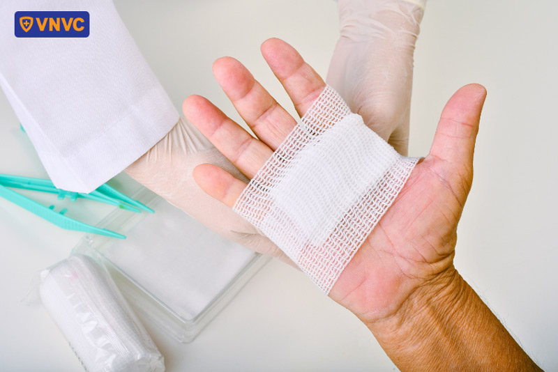 xử lý vết thương sau khi bị chó cắn