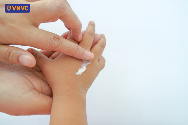 bôi thuốc theo toa của bác sĩ