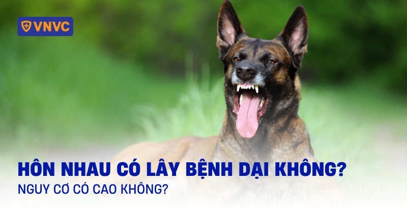 Hôn nhau có lây bệnh dại không? Nguy cơ có cao không?