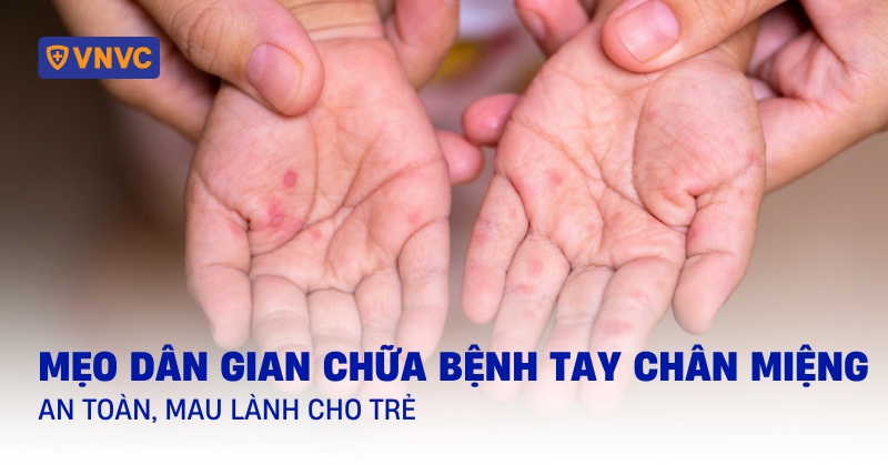 13 mẹo dân gian chữa bệnh chân tay miệng an toàn, mau lành