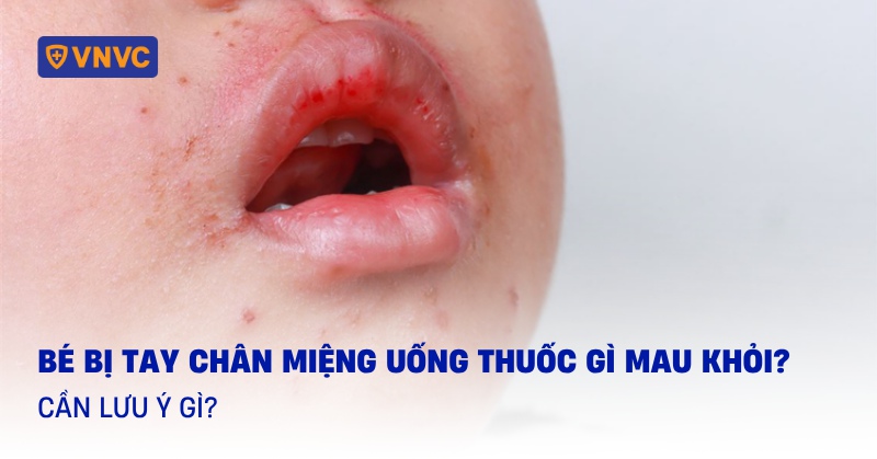tay chân miệng uống thuốc gì