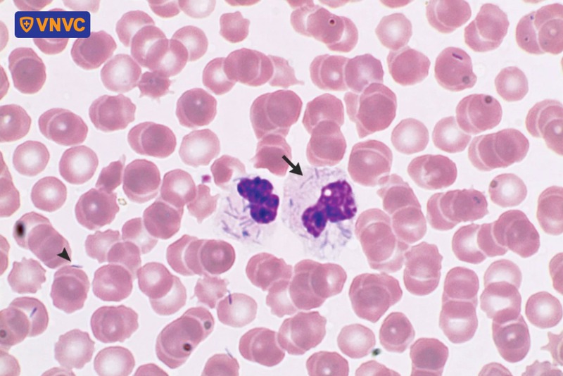 vi khuẩn Capnocytophaga