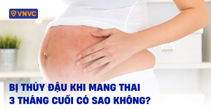 bị thủy đậu khi mang thai 3 tháng cuối