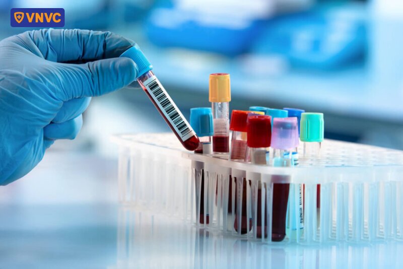 xét nghiệm máu phát hiện thủy đậu