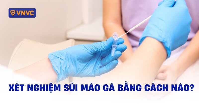 xét nghiệm sùi mào gà bằng cách nào