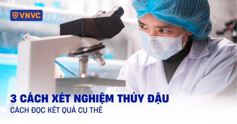 xét nghiệm thủy đậu