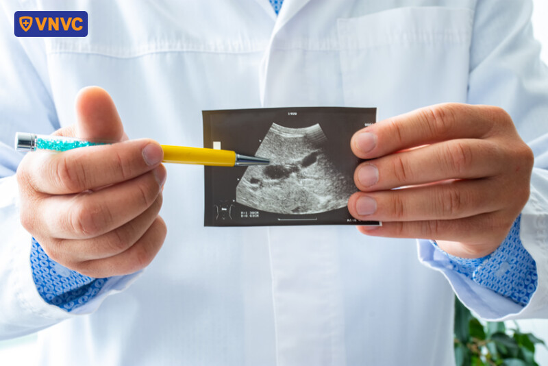 minh họa siêu âm dạ dày