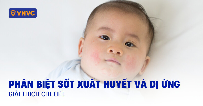 phân biệt sốt xuất huyết và dị ứng