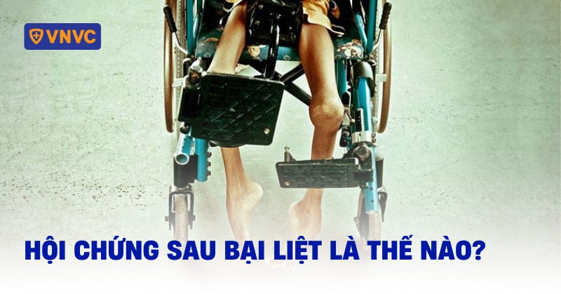 hội chứng sau bại liệt là thế nào