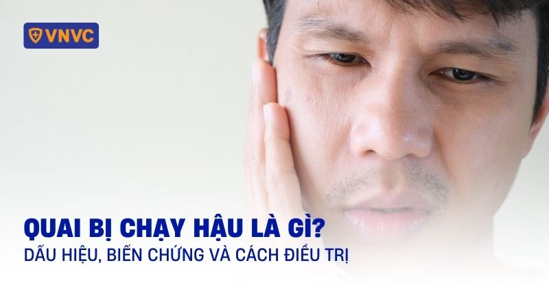 quai bị chạy hậu