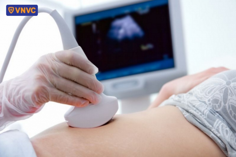 siêu âm thai