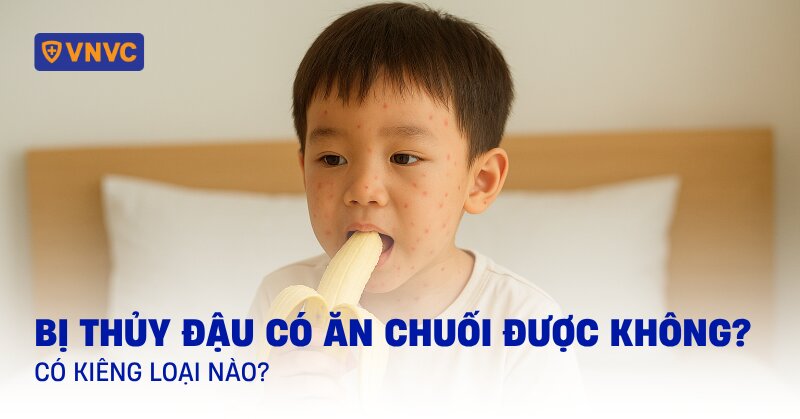 bị thủy đậu có ăn chuối được không