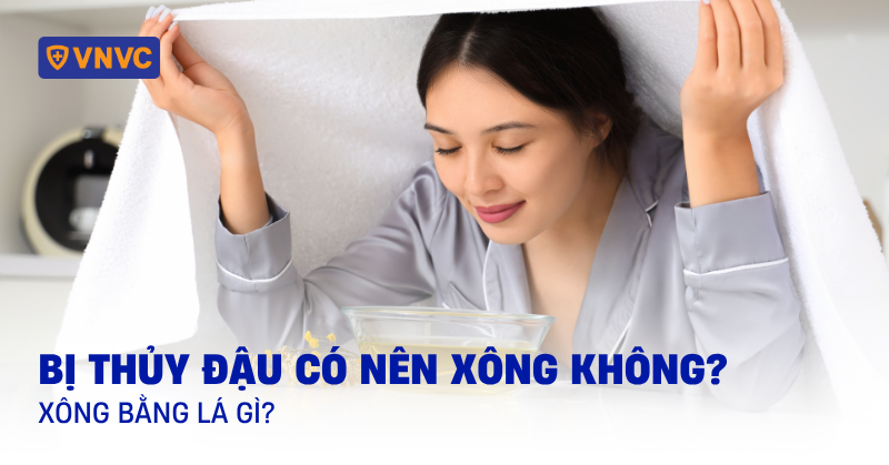 bị thủy đậu có nên xông không