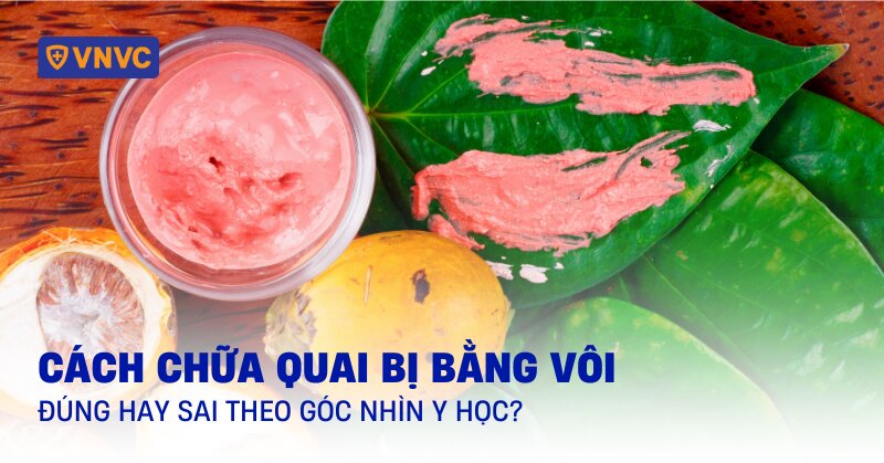 cách chữa quai bị bằng vôi