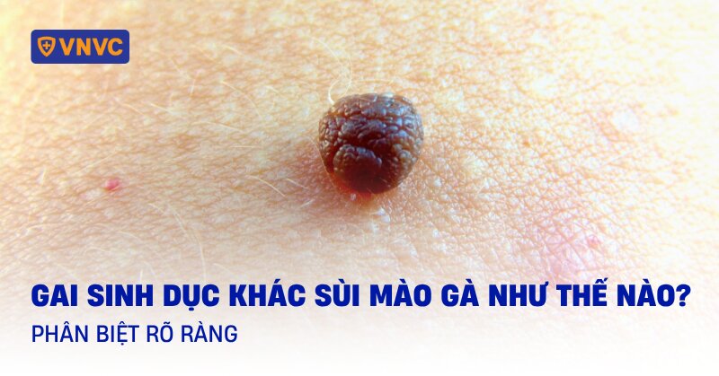 gai sinh dục và sùi mào gà