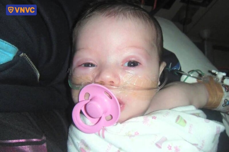 hình ảnh trẻ bị mắc bệnh ho gà