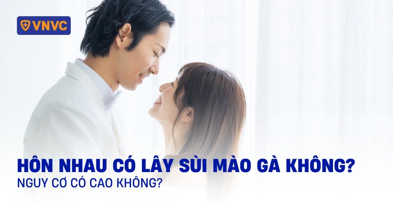 hôn nhau có lây sùi mào gà không