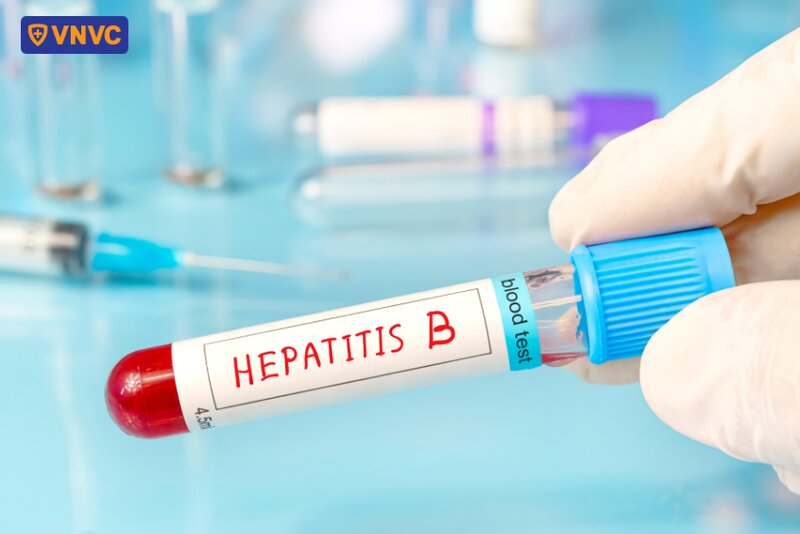 mẫu xét nghiệm viêm gan virus b