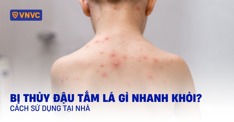 thuỷ đậu tắm lá gì