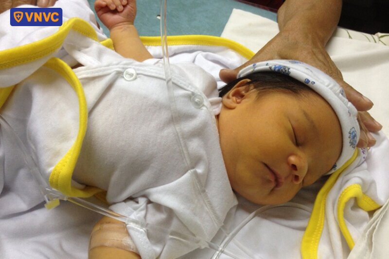 trẻ sơ sinh bị viêm gan do virus cmv