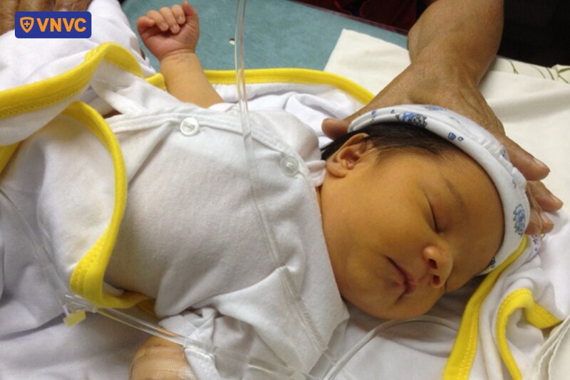 trẻ sơ sinh vàng da cần theo dõi