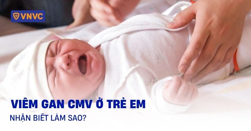 viêm gan cmv