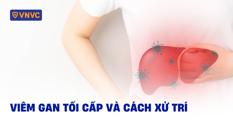 viêm gan tối cấp