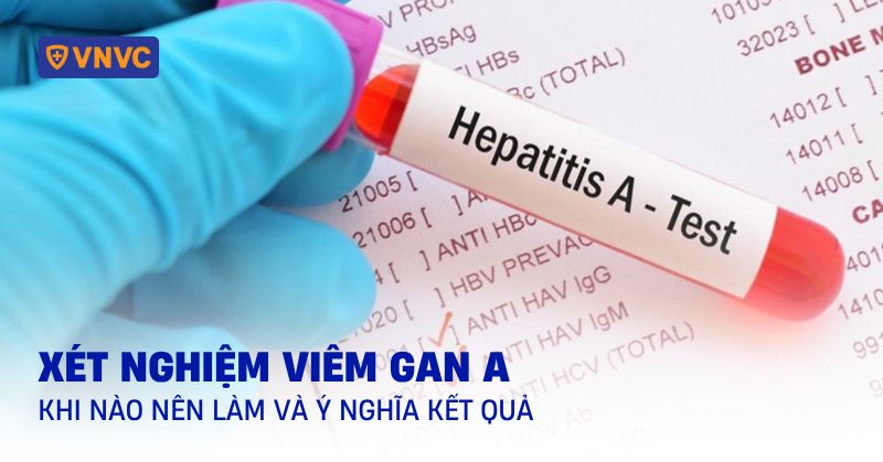 Xét nghiệm viêm gan A: Khi nào nên làm và ý nghĩa kết quả