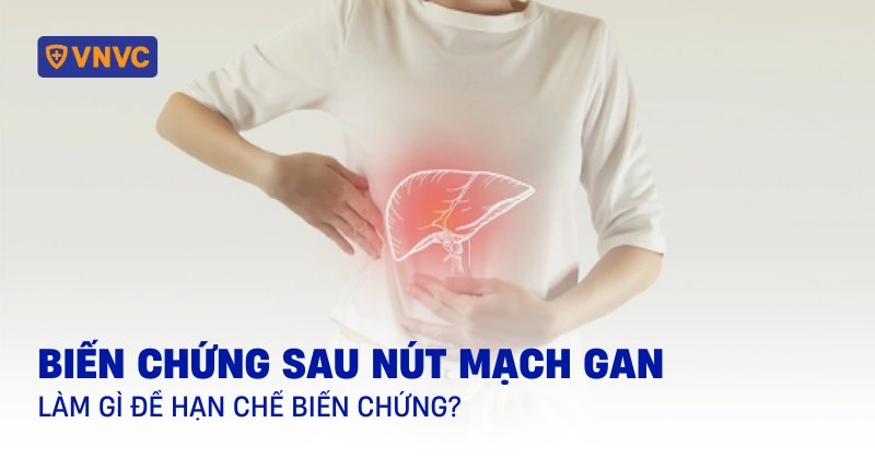 Biến chứng sau nút mạch gan