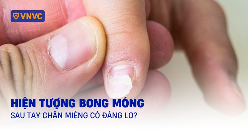 bong móng sau tay chân miệng