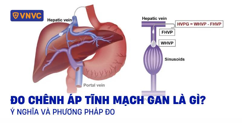 độ chênh áp tĩnh mạch gan