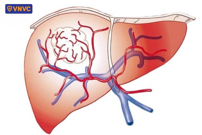 hệ thống động mạch gan chung