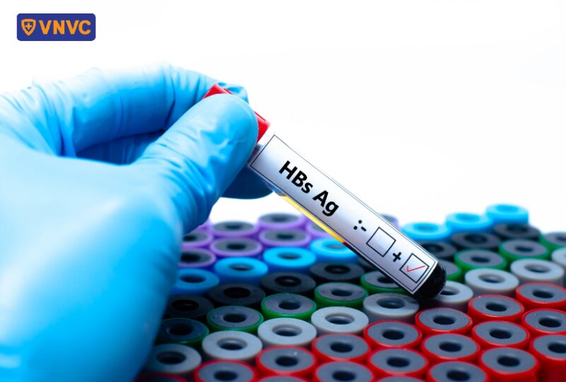 mẫu xét nghiệm hbsag