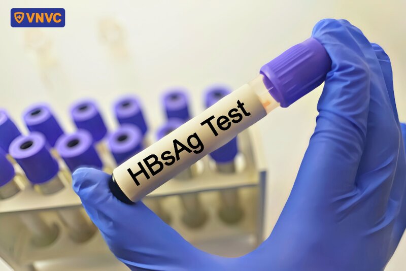 mẫu xét nghiệm hbsag