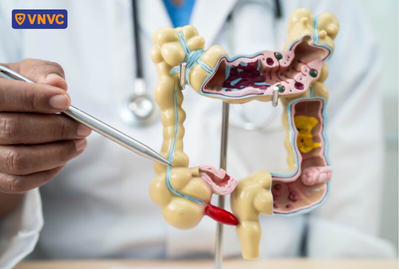 mô hình đường ruột